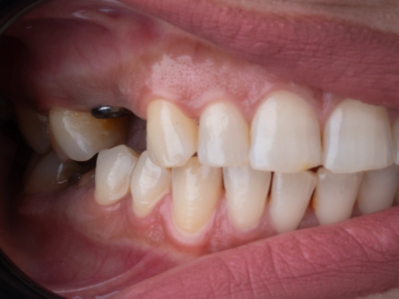 Before Image