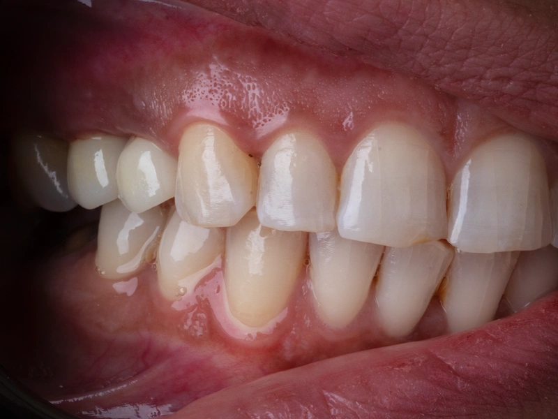After Image