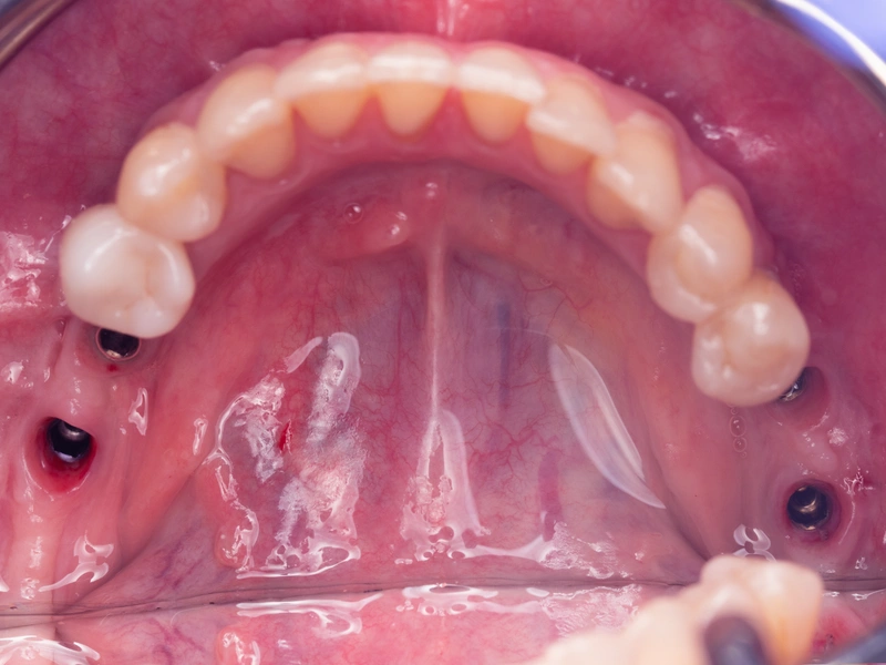 Before Image