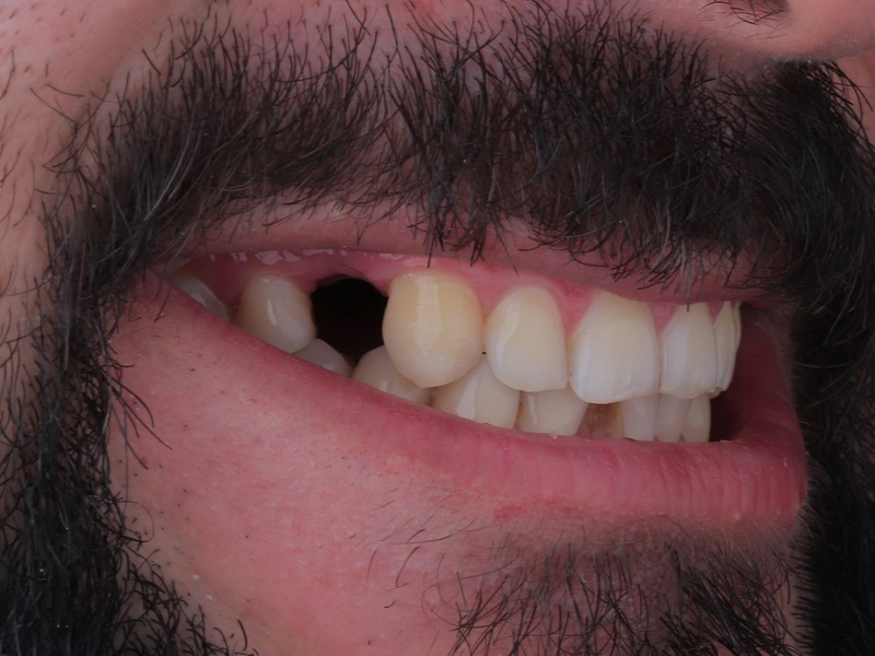 Before Image