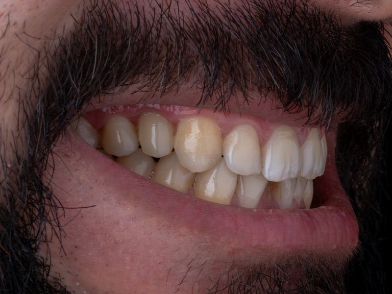 After Image