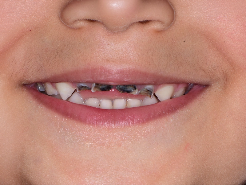 Before Image