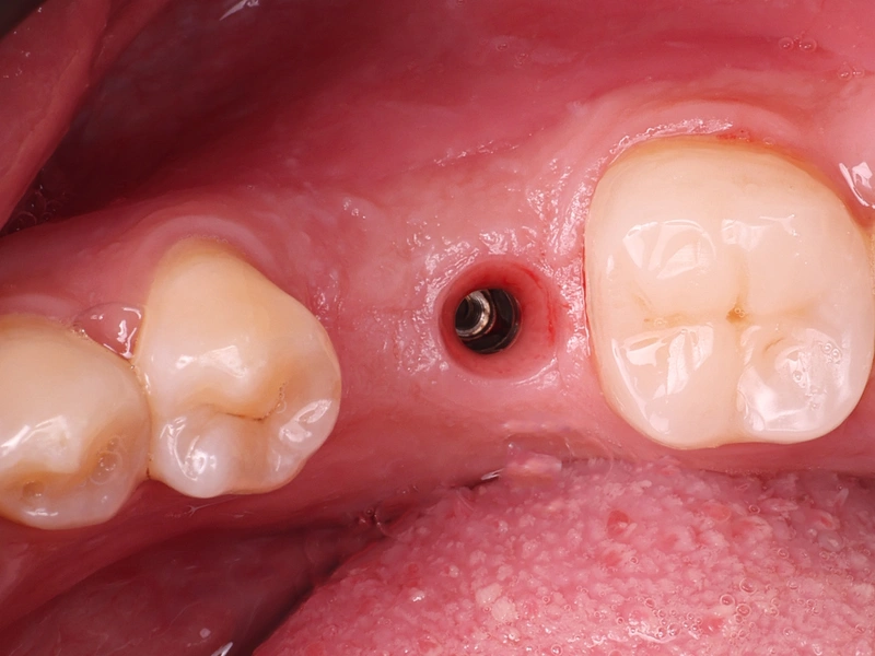 Before Image