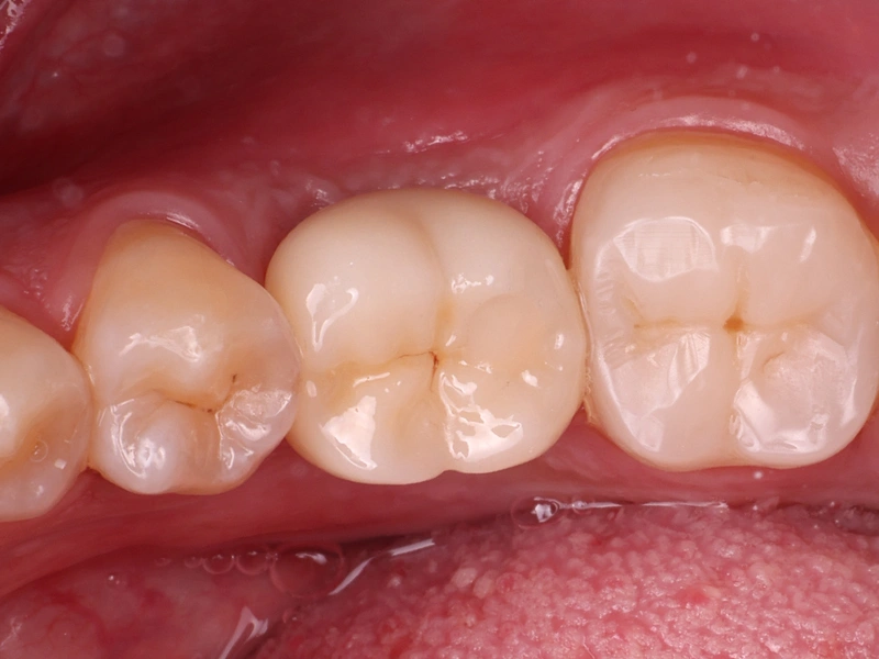 After Image