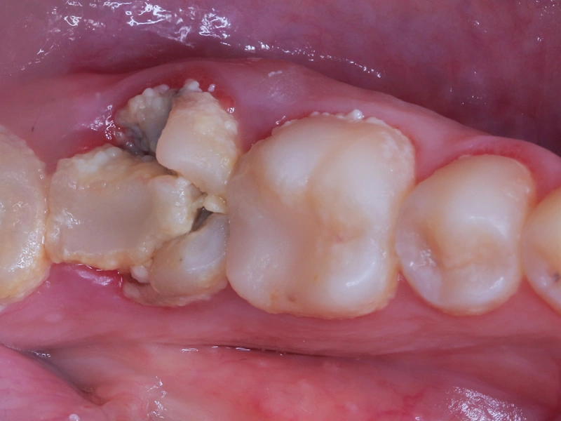 Before Image