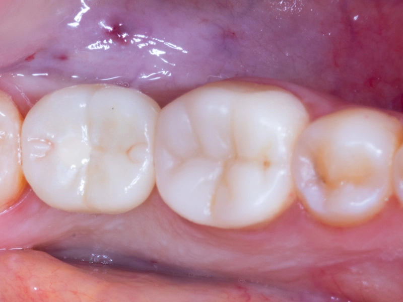 After Image